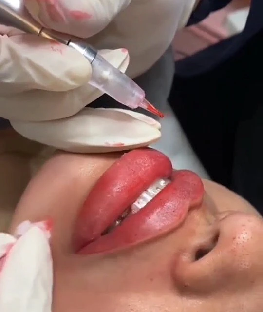 facial y labios