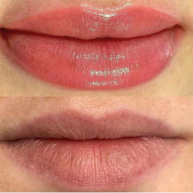 facial y labios