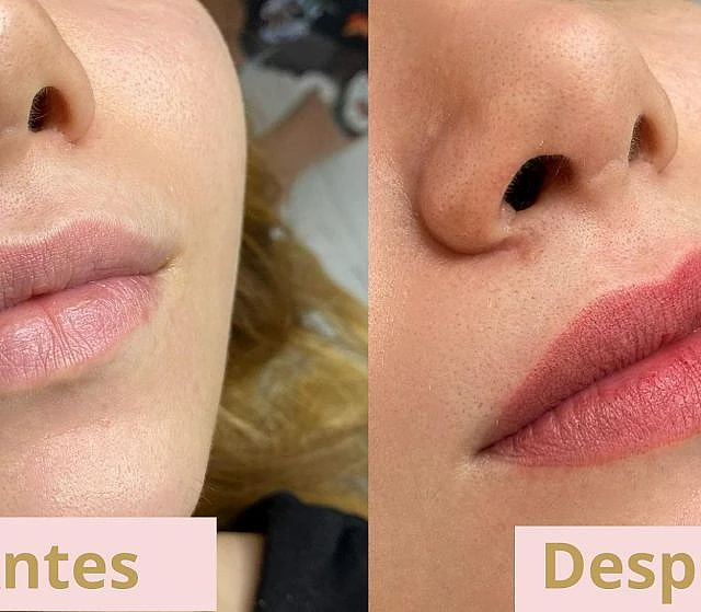 facial y labios